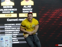 Sergey Kalinichenko will have surgical sutures removed on Wednesday. # Armwrestling # Armpower.net